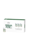 Farmona DERMAACNE+ Aktywny koncentrat normalizujący do twarzy 5x5 ml